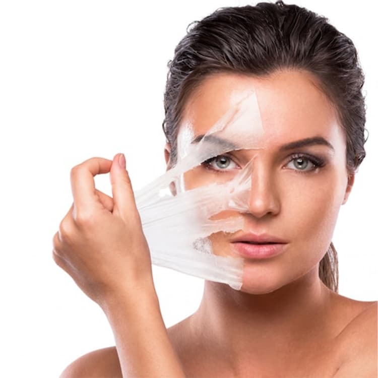 التقشير الكيميائي